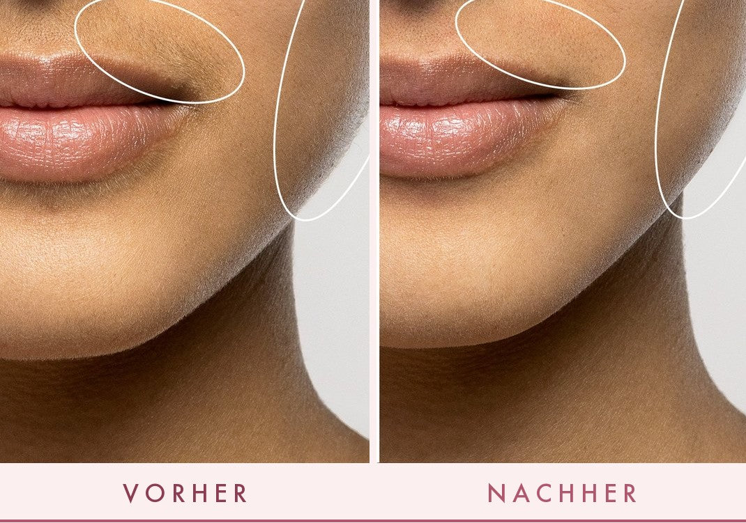 Vorher und nachher mit FLERMIX LUXE+