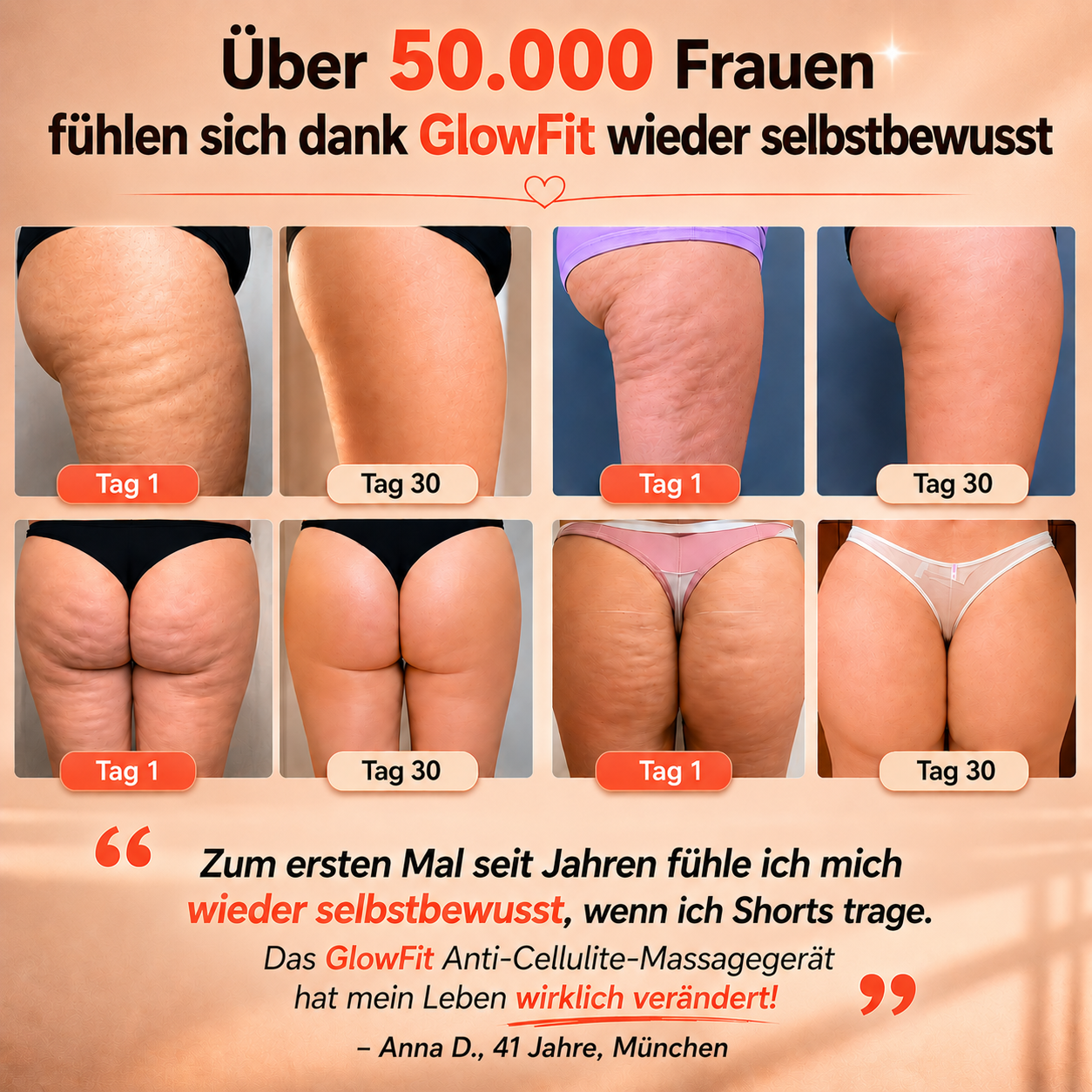 Über 50.000 Frauen haben sich für ELA entschieden · 90 Tage Garantie